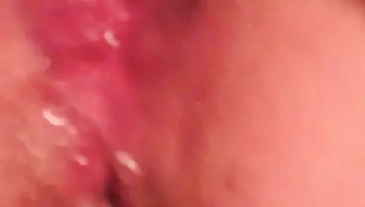 That asshole is almost perfect