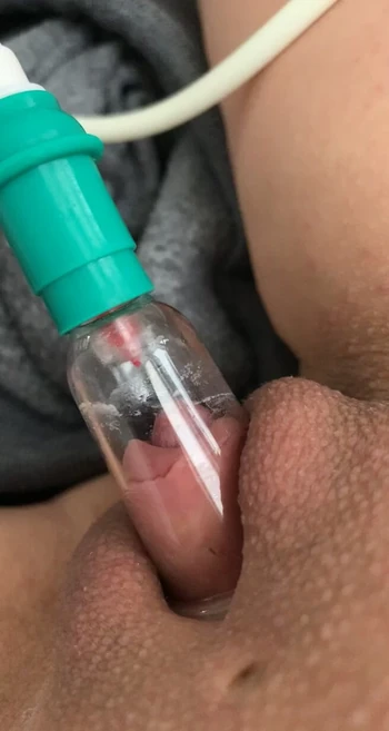 Накачка клитора