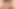 Micropenis dışarı çıkıp oynamayacak