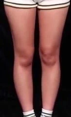 İşte miso'nun bacaklarının yakından görünümü