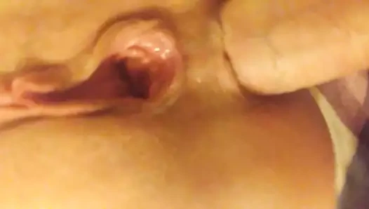 İkiz esnemeler motel #1