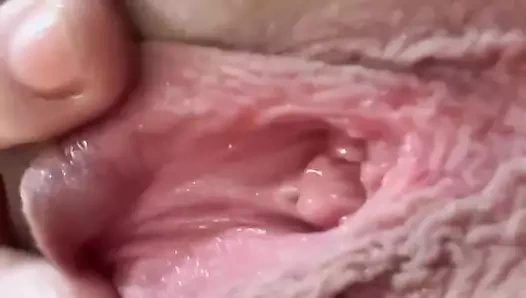 Göt deliğimde çilli