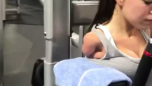 Her iki kolu da ampute