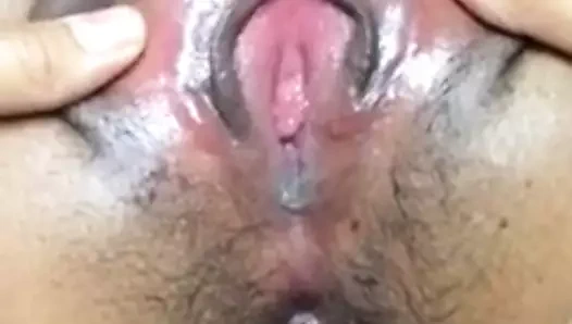 abanoz anal