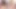 Rastgele porno yıldızları meme işleri - öncesi ve sonrası