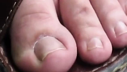 Ff24 kari'nin doğal parmakları