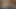 anal viyola 4