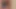 Büyük yaraklı tgirl ymdnls