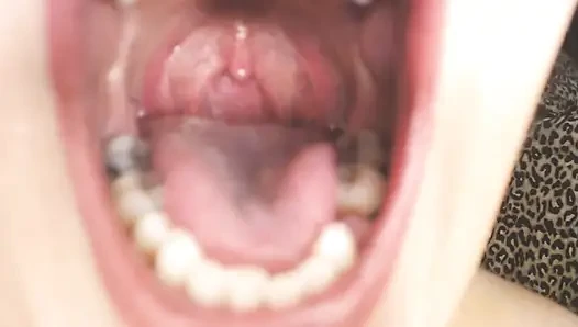 Gırtlağına ve ağzına tükürük ipleri olan Üveula Tonsils
