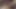 Transseksüel travesti sondaj üretral iç çamaşırı 26b