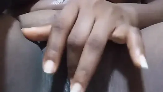 Parmaklama ve fışkırtma