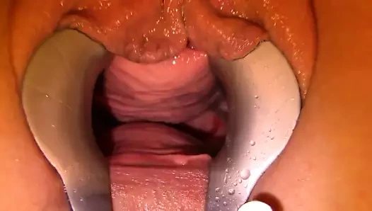 speculum et magic wand