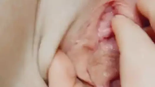 Fickspalte'imin buna ihtiyacı var!