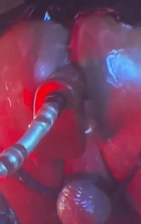 İleride yoğun sözlü oyun...