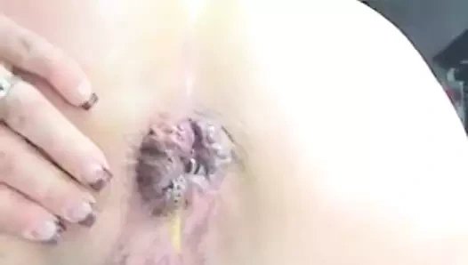 kadın aşırı anüs gevşek