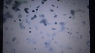 Dilatör, sperm mikroskobu ile orgazm