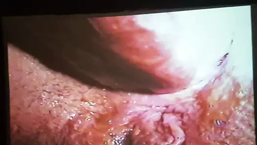 Anal derin göt geniş açık