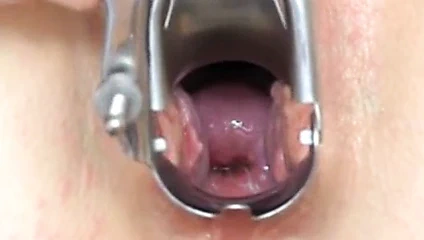 Uzun boylu kızıl iyice incelenir 2 / 2