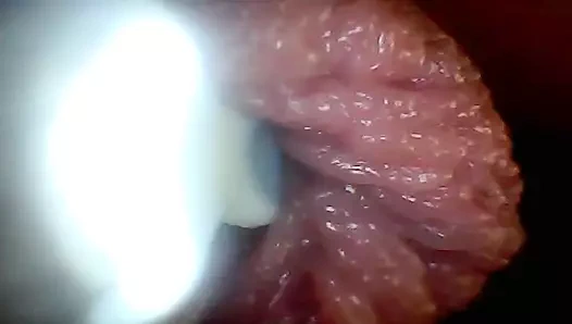 Endoskop kamera penis eğitim videosunda en hassas kısımlarını gösteriyor