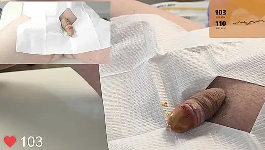 20 Fransız foley kateter sokma