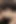 My Boyfriend Catches Me Having Sex with My Best Friend