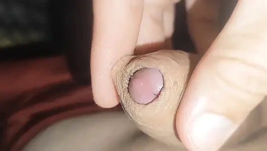 24 saatlik bitkin kontrolsüz ereksiyon