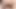Dildo üzerinde oturduktan sonra anal prolapsus