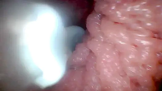 Hadi sulu amcığıma bir göz atalım (endoskop kamerası)