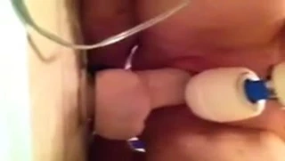 Fışkırtma, dong ve sihirli değnek