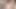 TEENY PUSSY STREACHED OUT. Resizing Teen Pussy