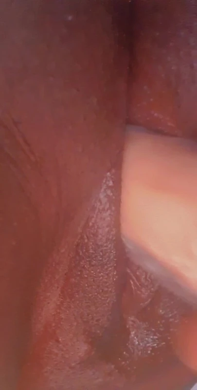 Возбужденная тинка