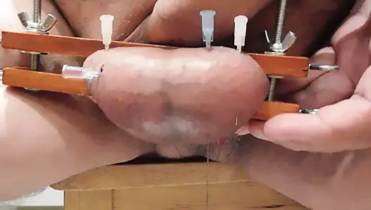 Yeni yarak baskısı