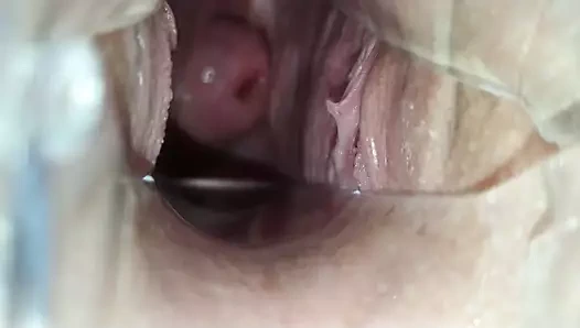 Jinekologda!! kızın amında bir spekulum!!