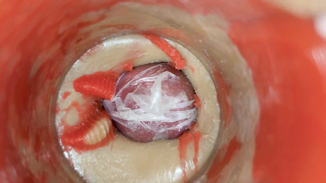 KONTROLSÜZ DALGALANMA AMCıĞı SONSUZ IÇ BASıNÇLA DOLDURUYOR