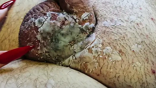 Ateşli mum ağdası cömertçe BDSM kölesinin taşaklarına ve yarağına dökülür. Erkek cinsel organlar için cbt ağda oyunu