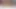 Sashastar & hotkinkyjo anal fisting tarafından alexthorn