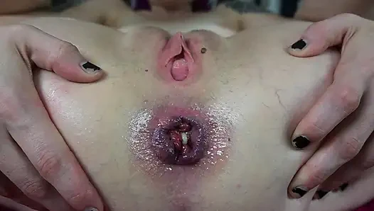 31 talimatı anal sarkma ve delik genişletme