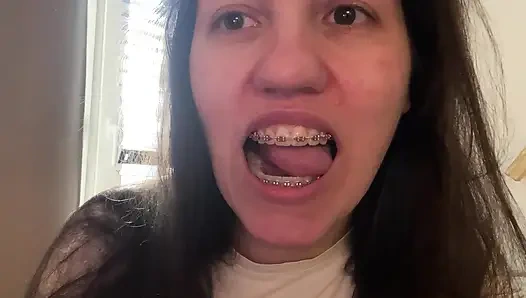 Dilinizle diş teli yalamak