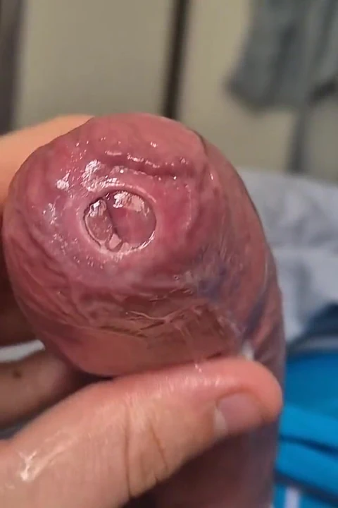 Phimosis yarak precum damlayan yakın çekim