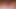 Seksi hemşire hastaların horoz ağrısını yatıştırır