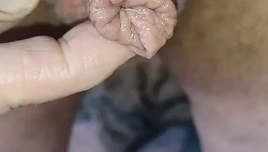 Minik sünnetsiz yavaş işiyor