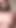 Mature prolapse her cervix while she toying her tight anus