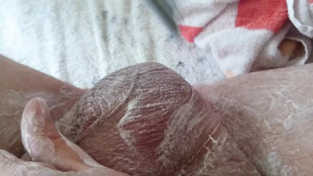 Hemşirelik göt deliğinden ve skrotumdan tıraş oluyor