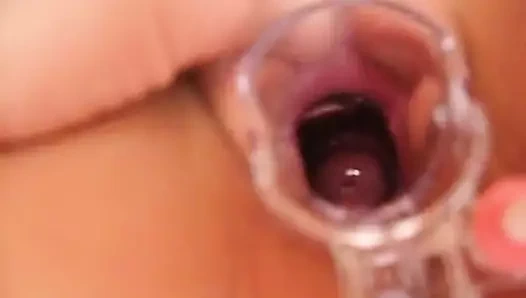 arkadaşım mary'nin ayaktan jinekolojik ziyareti