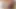 teen çekerek sünnet derisi gerizekalı onun dick