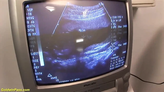 Kızıl saçlı hamile klinikte sikiliyor