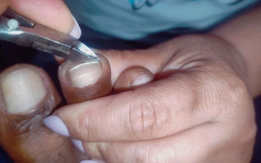 Gırtlak kraliçesi selfcare tırnak tedavisi