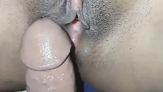 Anal tepsi