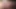 kateter ile işemek