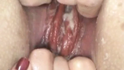 Bat anal kahrolası şaşkın ve prolapsus